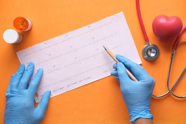 Lekarz sprawdza wyniki EKG